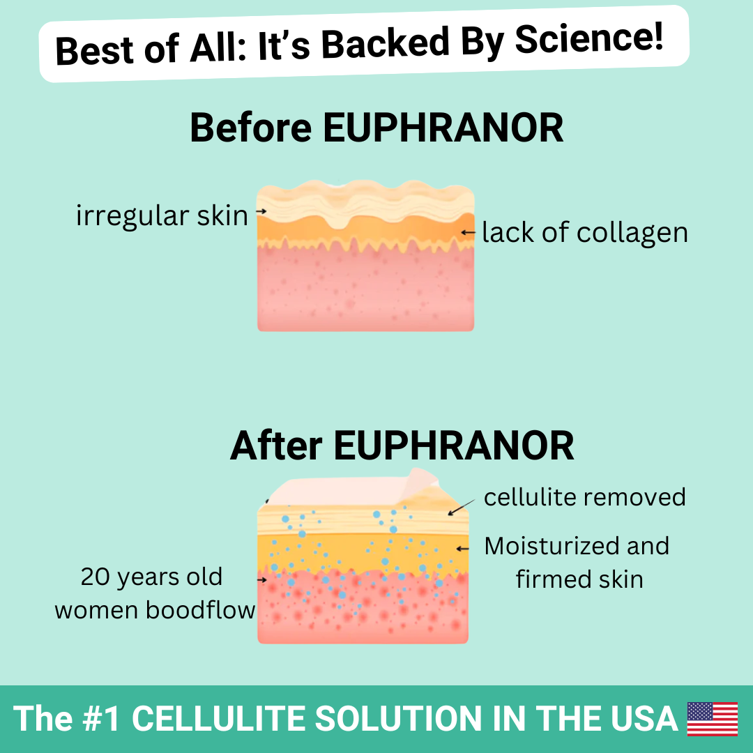 Euphranor™ : Say goodbye to your cellulite now